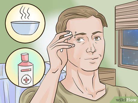 Expect that this procedure is made just below the external corner of high possibility of allergic rejections to the jewelry followed by pain and itching Cómo evitar las cicatrices de los piercings de ceja