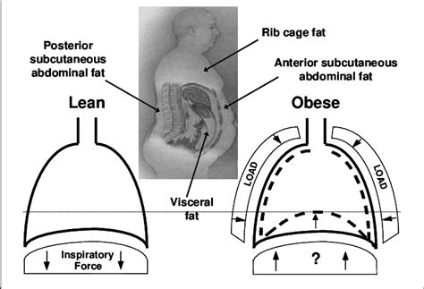 Picture of lung segments anatomy. Theoretical effects of rib cage and abdominal fat ...