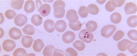 Malaria is a potentially life‑threatening tropical disease caused by plasmodium parasites, which are transmitted through the bite of an infected female anopheles mosquito. CDC - Parasites - Malaria