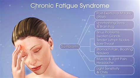 Chronic Fatigue Syndrome Shown & Explained Using A Medical Animation