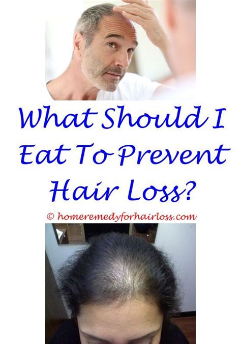 It started coming around the same time i began to use birth control. progressive hair loss - hair loss solutions future.hair ...