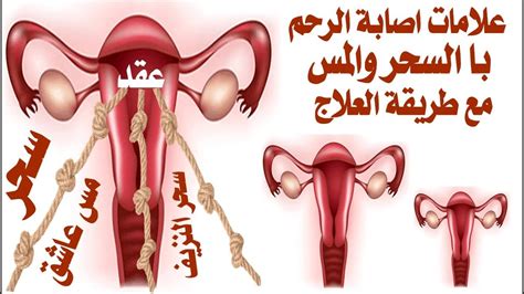 We did not find results for: علاج سحر الارحام بالقران , الوقاية من سحر عدم الانجاب ...