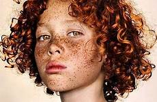 freckles freckle beauty breathtaking israeli rare undeniable show apparent solidarity instagrammer