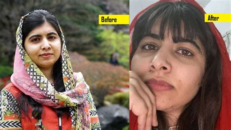 Malala yousafzai, who survived taliban assassination attempt, shares world's most prestigious honor with indian activist kailash. Malala Yousafzai cut her hairs during Self-isolation ...