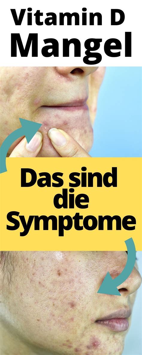 Vitamin d mangel gilt heute als eigenständige erkrankung. Die 7 eindeutigsten Anzeichen eines Vitamin D Mangels in ...