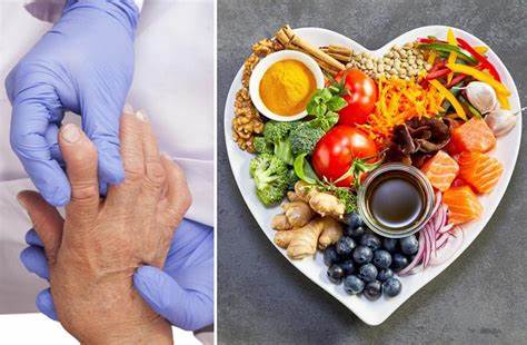 Подагрический артрит (диета, питание): лечение препараты (рекомендации Картинка - Подагрический артрит (диета, питание): лечение препараты (рекомендации