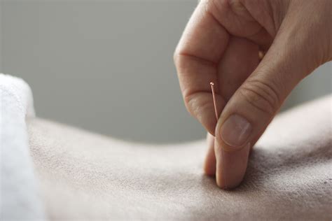 Akupunkturun amacı vücudun her tarafına akan enerji dengesini teşvik etmek ve. Akupunktur - ines-jahns Webseite!