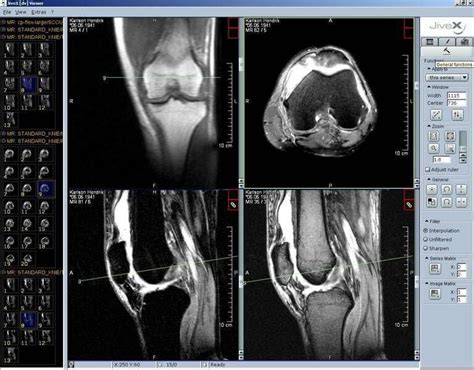 Dicom viewer mac freeware tudor dicom viewer v.1.9.1 tudor dicom viewer is a small, easy to use application specially designed to help you view and analyze dicom files with just a few clicks. Top 25 Free Dicom Viewers for Doctors, Medical Students ...