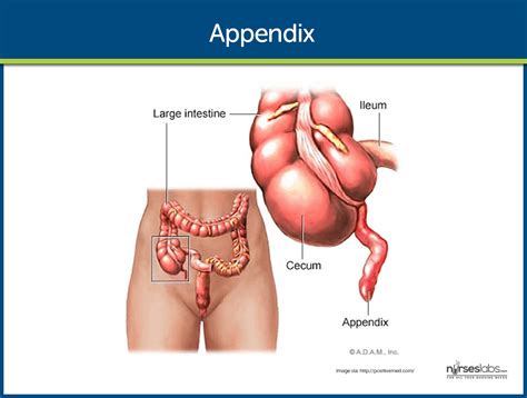 Appendicitis pain is characterized by an intense, debilitating abdominal pain that is usually considered as a surgical emergency. Appendicitis Nursing Care Management: Study Guide