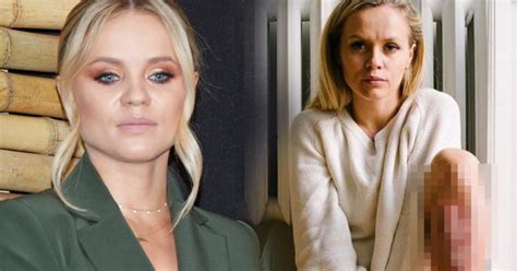 Anna skura zdobyła popularność dzięki prowadzeniu bloga _**what anna wears**_ oraz udziałowi w trzeciej jej córka wylała na nią wrzątek, a oparzenia na nodze pokazała na zdjęciu przy wyznaniu Anna Skura pokazała straszne OPARZENIA na nogach - apeluje ...