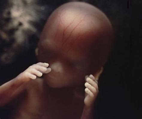 Bayi yesus hanya dapat dilihat orang pembesar dan kaya. 25 Gambar Pembentukan Bayi Dalam Kandungan Setelah 12 Tahun Dirakam. Menakjubkan!