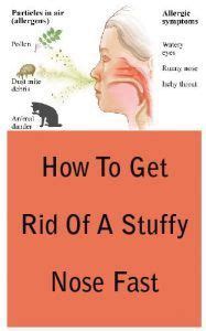 Getting rid of a stuffy nose | Stuffy nose remedy, Cold ...
