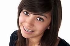 braces teenage orthodontics glimlachen steunen lächeln orthodontic klammern chirurgia parentesi graffe sorridendo olson porady noszenia aparat problemy podczas ortodontyczny nie