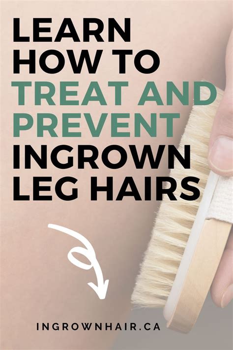 It can cause inflammation, pain and tiny bumps in the area where the hair was removed. Ingrown hair- How to prevent and treat them effectivly ...