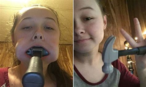 However, flagging something does not mean that it gets automatically removed. Louisiana teen gets a hammer stuck in her mouth | Daily ...