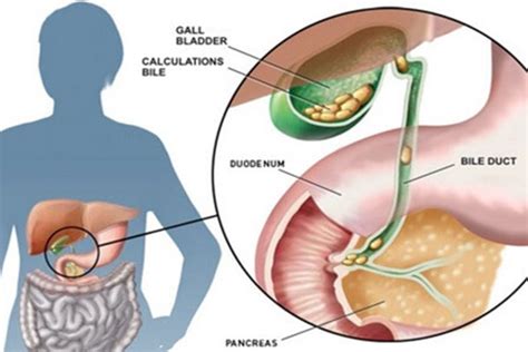 Kalau kamu pernah kencing warna apa sob.? Paling Populer 24+ Gambar Warna Urine - Gani Gambar