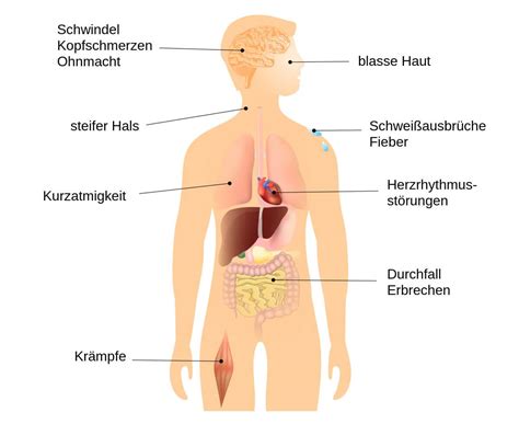 Quelles sont ses causes et comment le soigner ? Niedriger Blutdruck Die 28 Symptome der Hypotonie