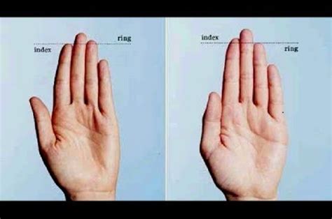 Check spelling or type a new query. Gambar Tangan Di Infus Asli Perempuan