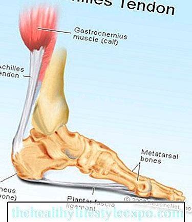 Aşil tendonu kopması, ısınmadan yapılan spor karşılaşmaları, ani ve aşırı zorlanmalar ve ayak topuğu bölgesine alınan darbeler aşil tendonu kopmasına sebep olabilir. Aşil Tendon Kopması - Ilk yardım ve yaralanmalar - 2020