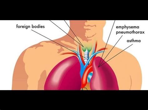 Maybe you would like to learn more about one of these? اسباب ضيق التنفس , اعراض واسباب ضيق التنفس - قلوب فتيات