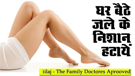11 female burn survivors come together for a beautiful photoshoot / how to get rid of smelly feet (2) (3) (4). जले के निशान हटाने का सही और आसान तरीका ||How to get rid ...