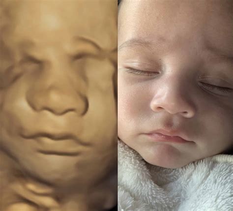 4d scans baby
