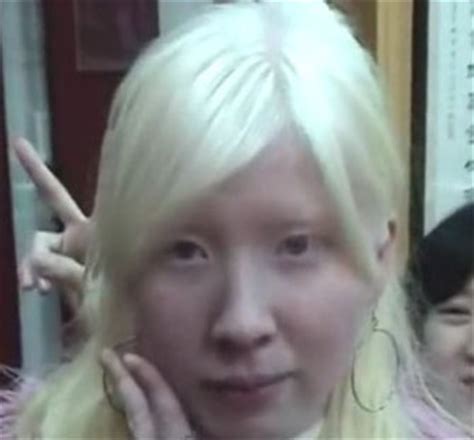 Find over 100+ of the best free asian woman images. Sexy Asian Albino girl and other albino asians ...