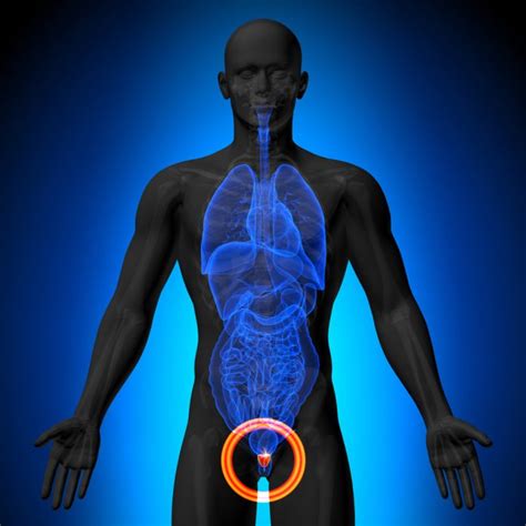 Women should follow the american cancer society guidelines for cancer early detection, especially those for breast cancer. Does Testosterone Cause Prostate Cancer? Can Men Treated ...