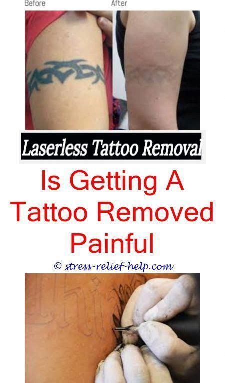 This article covered them all from home tattoo removal to natural tattoo removal methods in this is a completely natural tattoo removal that doesn't cause pain and it is very safe to use. Laser tattoo removal essex.Can tattoo removal be dangerous ...