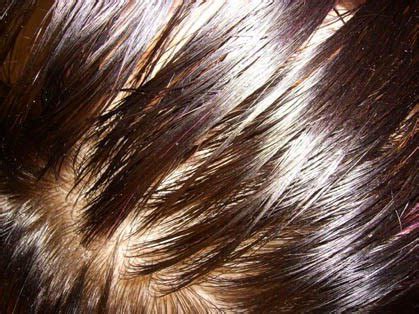 4 deep condition your hair and scalp once a week. How To Treat Oily Scalp