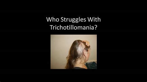I was terrified of facing the unhealed trauma of my dysfunctional childhood in an alcoholic home. Trichotillomania: Unhealed Childhood Trauma - YouTube