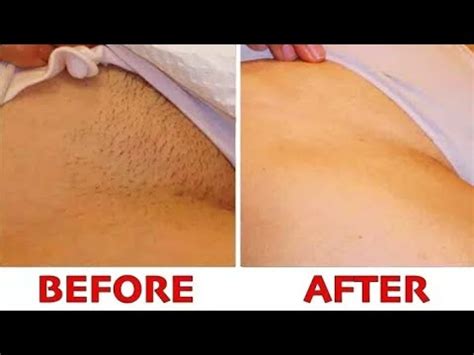 It is not easy to do it to yourself, but with a little practice and a lot of pat. STOP SHAVING!!! PROPER WAY TO REMOVE PUBIC HAIR WITHOUT ...