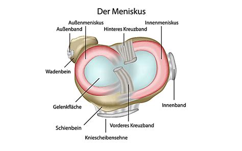 Das knie kann folglich weder gebeugt noch gestreckt werden. Meniskusriss - PHYSIOZENTRUM