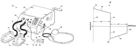 3 the latter position is also recommended in patients with implanted defibrillators or pacemakers. Patent US6597949 - Mechanically powered external ...