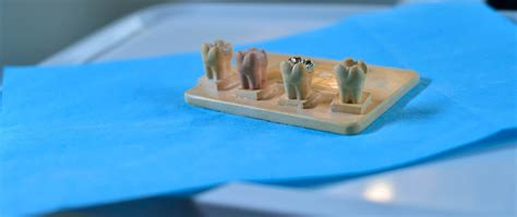 Maybe you would like to learn more about one of these? Amalgamsanierung - Zahnarztpraxis Dr. Fenske
