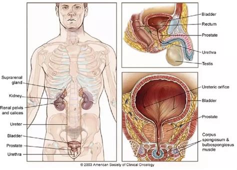 The cure for cancer, however, has been quite elusive. What type of recovery should I expect after a prostate ...