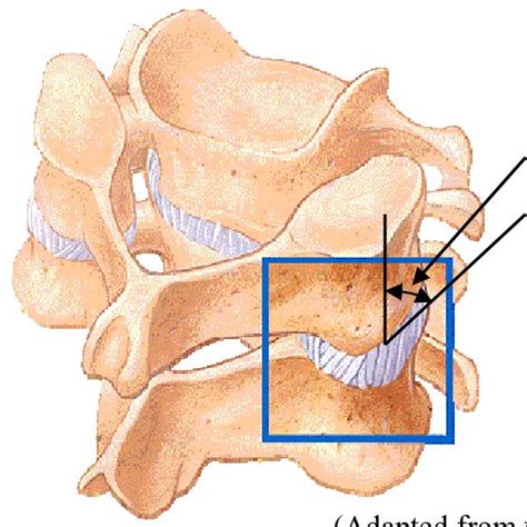 Muscles diagram front and back below you'll find several different muscles diagrams. Posterior view of the deep neck and back muscles ...