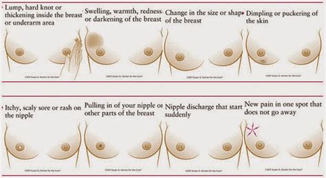 However, these signs and symptoms are most often associated with benign breast. Let's Understanding: What Does Inflammatory Breast Cancer ...