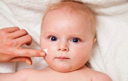 Диета дерматит крапивница Атопичен дерматит при деца, лечение, диета и примамка Атопичен дерматит при деца, лечение, диета и примамка Диета дерматит крапивница