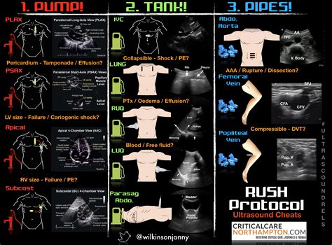 This examination is performed using standard ultrasound equipment present the rush exam. RUSH Protocol: Rapid Ultrasound for Shock and Hypotension ...