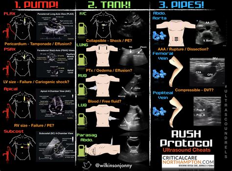 Check out the 5 minute sono videos below RUSH Protocol: Rapid Ultrasound for Shock and Hypotension ...