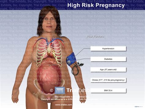 They should also recommend that these. High Risk Pregnancy - TrialExhibits Inc.