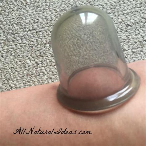 How and when can i expect to receive my itin? Cupping Therapy Benefits and Uses | All Natural Ideas