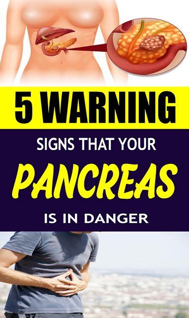 The most common type of cancer that forms in the. 5 Warning Signs That Your Pancreas Is In Danger | Pijn