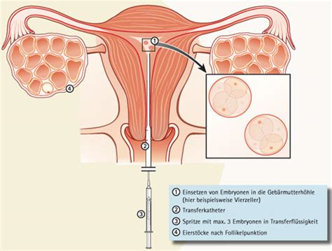 Maybe you would like to learn more about one of these? كيف تتم عملية التلقيح الصناعى للحمل بالصور , ادخال الحيوان ...