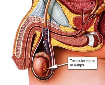 Testicular cancer is cancer that develops in the testicles, a part of the male reproductive system. Cancer Symptoms Information: Testicular Cancer Symptoms