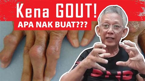 Selaput dara isteri ini masih belum pecah dan dia masih dara! Kena GOUT! APA NAK BUAT?! - YouTube