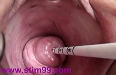 vagina cervix insertion uterus 720p
