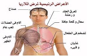 (focal segmental glomerulosclerosis ( fsgs. adindanurul: مرض يطلق عليه حمى المستنقعات ينتقل عن طريق البعوض