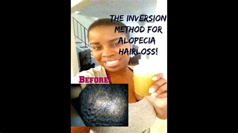 Just like the name, the inversion method is a hair growth treatment where a person inverts the body upside down or in a slightly inverted angle. The Inversion Method to Grow Hair From Hair Loss/ Alopecia ...